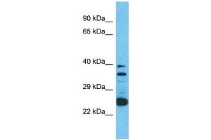 Western Blotting (WB) image for anti-Olfactory Receptor, Family 2, Subfamily A, Member 12 (OR2A12) (C-Term) antibody (ABIN2791718)