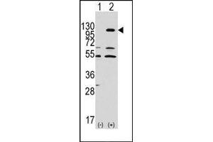 Western blot analysis of EphA7 (arrow) using rabbit polyclonal EphA7 Antibody. (EPH Receptor A7 antibody)