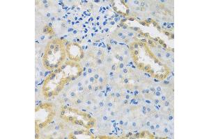 Immunohistochemistry of paraffin-embedded rat kidney using PMPCB antibody at dilution of 1:100 (x40 lens). (PMPCB antibody)