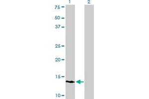 Western Blot analysis of POLR3K expression in transfected 293T cell line by POLR3K monoclonal antibody (M01), clone 3F5.