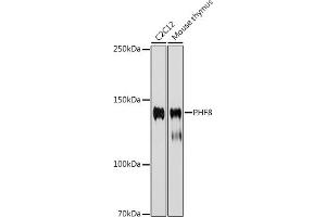 Western blot analysis of extracts of various cell lines, using PHF8 antibody (ABIN7269263) at 1:1000 dilution. (PHF8 antibody)