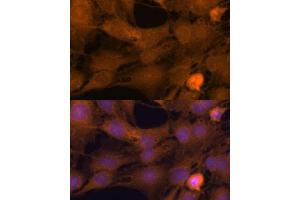 Immunofluorescence analysis of C6 cells using ZC3H7A antibody (ABIN6131068, ABIN6150400, ABIN6150401 and ABIN6217095) at dilution of 1:100. (ZC3H7A antibody  (AA 1-220))