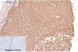 Immunohistochemical analysis of paraffin-embedded human liver tissue. (KRT17 antibody)