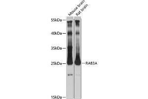 Western blot analysis of extracts of various cell lines, using RA antibody (ABIN7269809) at 1:3000 dilution. (RAB3A antibody  (AA 100-200))