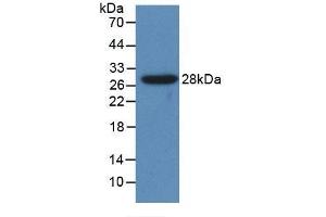 Detection of Recombinant CYP1A1, Human using Polyclonal Antibody to Cytochrome P450 1A1 (CYP1A1) (CYP1A1 antibody  (AA 1-250))