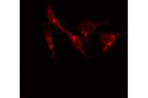 ABIN6274218 staining Hela cells by IF/ICC.