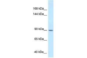 WB Suggested Anti-DACT1 Antibody Titration: 1. (DACT1 antibody  (Middle Region))
