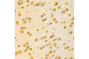 Immunohistochemistry (IHC) image for anti-Lamin B1 (LMNB1) (AA 397-586) antibody (ABIN3015698)