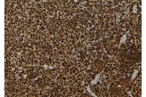anti-Casein Kinase 1, gamma 2 (CSNK1G2) (C-Term) antibody