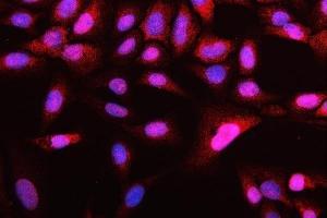 IF analysis of ATG14L using anti-ATG14L antibody (ABIN3043721).
