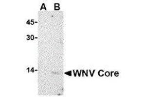 Western Blotting (WB) image for anti-2'-5' Oligoadenylate Synthetase 1B (OAS1B) (C-Term) antibody (ABIN2477148) (OAS1B antibody  (C-Term))