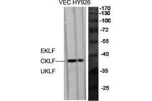 Western Blot (WB) analysis of specific cells using EKLF/CKLF/UKLF Polyclonal Antibody. (EKLF/CKLF/UKLF (C-Term) antibody)