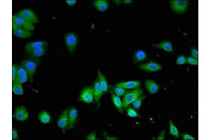 Immunofluorescent analysis of HepG2 cells using ABIN7170102 at dilution of 1:100 and Alexa Fluor 488-congugated AffiniPure Goat Anti-Rabbit IgG(H+L) (SLC13A5 antibody  (AA 156-204))
