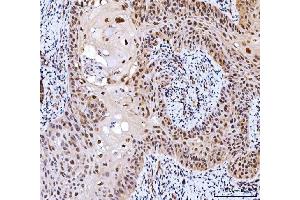 IHC analysis of CSNK2K2 using anti-CSNK2K2 antibody (ABIN7602871). (CSNK2A2 antibody  (C-Term))