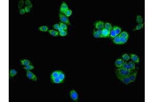 Immunofluorescent analysis of PC-3 cells using ABIN7145043 at dilution of 1:100 and Alexa Fluor 488-congugated AffiniPure Goat Anti-Rabbit IgG(H+L) (ATAD3B antibody  (AA 1-240))