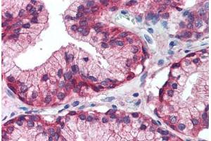 Human Prostate (formalin-fixed, paraffin-embedded) stained with EGFR antibody ABIN457474 at 5 ug/ml followed by biotinylated secondary antibody, alkaline phosphatase-streptavidin and chromogen.