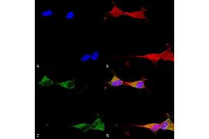 Immunocytochemistry/Immunofluorescence analysis using Mouse Anti-Ataxin 1 Monoclonal Antibody, Clone S65-37 (ABIN1741533). (Ataxin 1 antibody  (AA 746-761) (FITC))