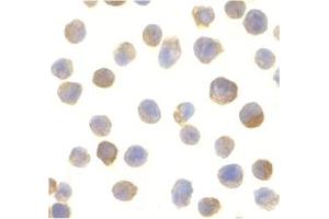 Image no. 2 for anti-C1q and Tumor Necrosis Factor Related Protein 2 (C1QTNF2) antibody (ABIN207843) (C1QTNF2 antibody)