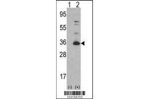 Western blot analysis of CDK4 using rabbit polyclonal CDK4 Antibody using 293 cell lysates (2 ug/lane) either nontransfected (Lane 1) or transiently transfected with the CDK4 gene (Lane 2).