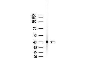 Western blot analysis of lysates from EC304 cells, using NDUF Antibody at 1/1000 dilution.