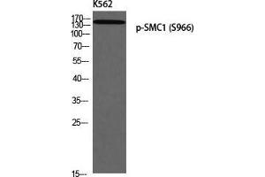 Western Blot (WB) analysis of K562 using p-SMC1 (S966) antibody. (SMC1A antibody  (pSer966))