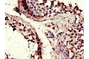 Immunohistochemistry of paraffin-embedded human testis tissue using ABIN7172803 at dilution of 1:100 (TACC3 antibody  (AA 133-268))