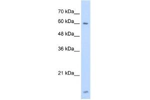 WB Suggested Anti-HNRPL Antibody Titration:  1. (HNRNPL antibody  (N-Term))