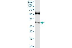 Immunoprecipitation of SNAI1 transfected lysate using anti-SNAI1 MaxPab rabbit polyclonal antibody and Protein A Magnetic Bead , and immunoblotted with SNAI1 purified MaxPab mouse polyclonal antibody (B02P) . (SNAIL antibody  (AA 1-264))