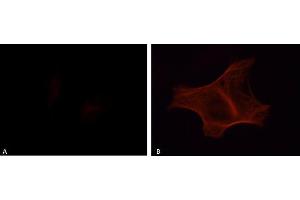 Immunofluorescence analysis of HeLa transfected cells stained with the anti-phospho-Tau (Tyr18) antibody, 1:200 dilution:  A: Tau,  B: Tau + Fyn (tau antibody  (pTyr18))