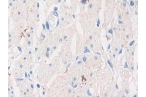 Immunohistochemistry (IHC) image for anti-Tubulin Polymerization Promoting Protein (Tppp) (AA 8-210) antibody (ABIN7439996)