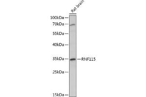 RNF115 Antikörper  (AA 30-140)