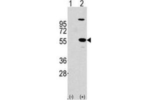 Image no. 2 for anti-Aldehyde Dehydrogenase 1 Family, Member A1 (ALDH1A1) (Center) antibody (ABIN356973) (ALDH1A1 antibody  (Center))