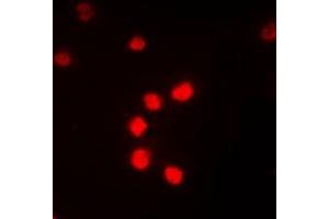 Immunofluorescent analysis of ZNF682 staining in Jurkat cells.