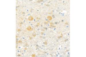 Immunohistochemistry analysis of paraffin embedded mouse cerebellum using Erc2 (ABIN7073808) at dilution of 1: 3000 (ERC2 antibody)