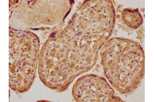 IHC image of ABIN7166428 diluted at 1:400 and staining in paraffin-embedded human placenta tissue performed on a Leica BondTM system. (LOX antibody  (AA 23-285))