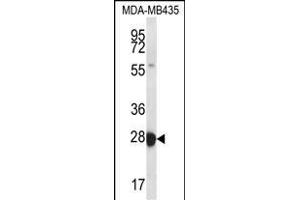 RAB27B Antibody (Center) (ABIN656670 and ABIN2845910) western blot analysis in MDA-M cell line lysates (35 μg/lane).
