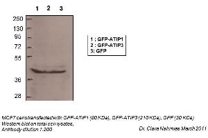 WB Suggested Anti-MTUS1 Antibody Titration:    Positive Control:  Total Cell Lysates (MTUS1 antibody  (N-Term))