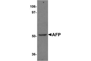 Western blot analysis of AFP in human liver tissue lysate with AFP Antibody (N-term) at 1 μg/ml.