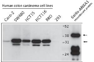 Western Blotting (WB) image for anti-Annexin A1 (ANXA1) antibody (ABIN2703590) (Annexin a1 antibody)