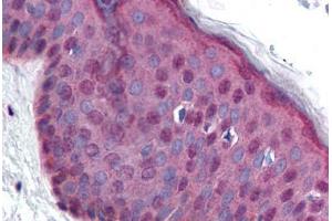 Human Skin (formalin-fixed, paraffin-embedded) stained with MDM2 antibody ABIN214211 at 10 µg/ml followed by biotinylated anti-mouse IgG secondary antibody ABIN481714, alkaline phosphatase-streptavidin and chromogen. (MDM2 antibody  (AA 154-167))