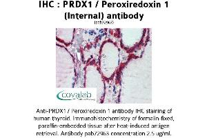 Image no. 2 for anti-Peroxiredoxin 1 (PRDX1) (Internal Region) antibody (ABIN1738319)