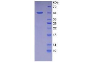 Image no. 1 for Natriuretic Peptide A (NPPA) (AA 25-152) protein (His tag,GST tag) (ABIN4988365)