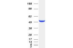 KIAA1609 Protein (Myc-DYKDDDDK Tag)