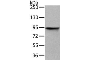 Gel: 6 % SDS-PAGE, Lysate: 40 μg, Lane: HT-29 cell, Primary antibody: ABIN7128081(VIL1 Antibody) at dilution 1/250 dilution, Secondary antibody: Goat anti rabbit IgG at 1/8000 dilution, Exposure time: 3 seconds (Villin 1 antibody)