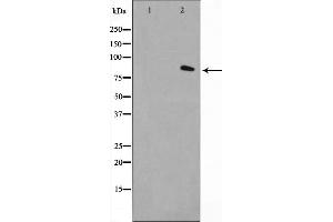 Western blot analysis on LOVO cell lysate using FAP-1 Antibody，The lane on the left is treated with the antigen-specific peptide. (FAP antibody  (Internal Region))