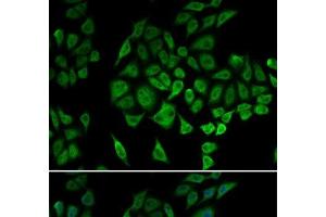 Immunofluorescence analysis of U2OS cells using NDUFS1 Polyclonal Antibody (NDUFS1 antibody)