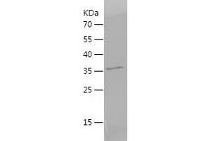 Western Blotting (WB) image for Charcot-Leyden Crystal Protein (CLC) (AA 1-142) protein (His-IF2DI Tag) (ABIN7284196) (Galectin 10 Protein (AA 1-142) (His-IF2DI Tag))