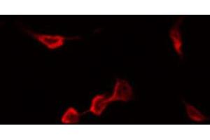 ABIN6267548 staining Hela by IF/ICC. (CCR5 antibody  (pSer336))
