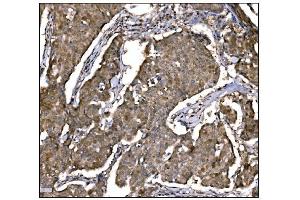 IHC analysis of Caspase-9/CASP9 using anti-Caspase-9/CASP9 antibody (ABIN7600340). (Caspase 9 antibody  (AA 18-416))