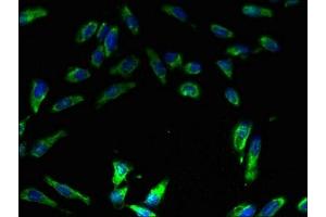 Immunofluorescent analysis of Hela cells using ABIN7175250 at dilution of 1:100 and Alexa Fluor 488-congugated AffiniPure Goat Anti-Rabbit IgG(H+L) (ATP6V1E1 antibody  (AA 2-224))